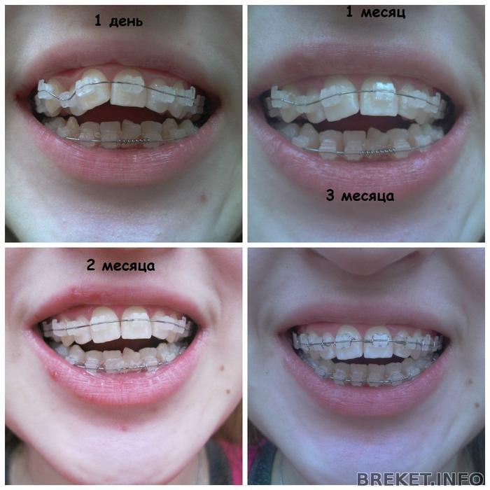 collage4.jpg
