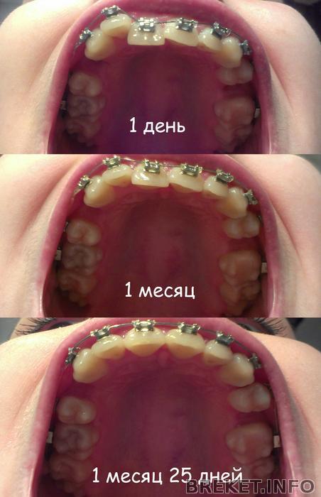 Сравнение. 1 день - 1 месяц 25 дней