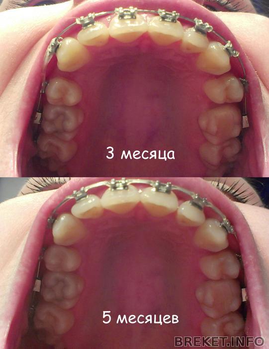 Сравнение 3-5 месяцев.jpg