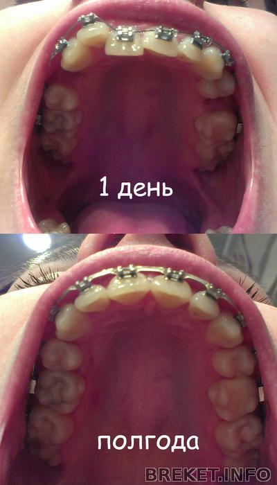 Сравнение 1 день-полгода