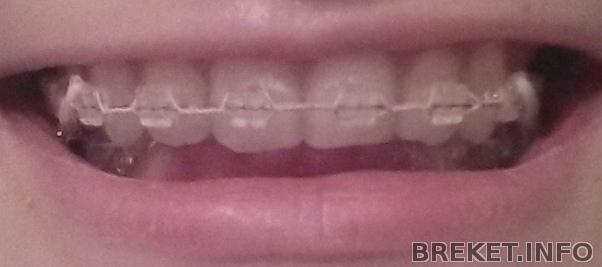 20140311_192234.jpg