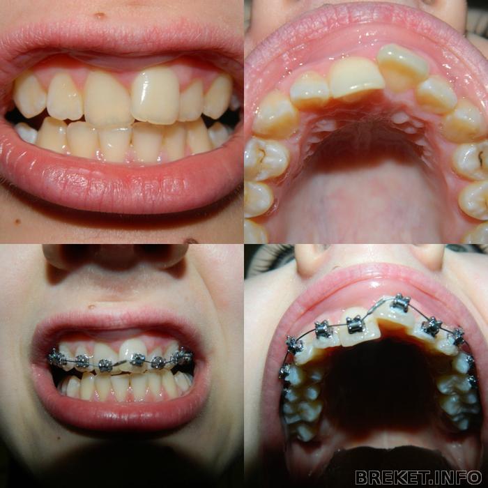 picmonkey_collagerd.jpg