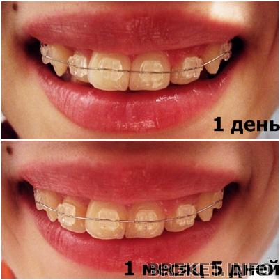 kollazh_1_mesyac_i_5_dney.jpg