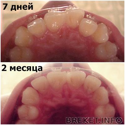 kollazh_2_mesyaca_10_dney_vid_snizu.jpg