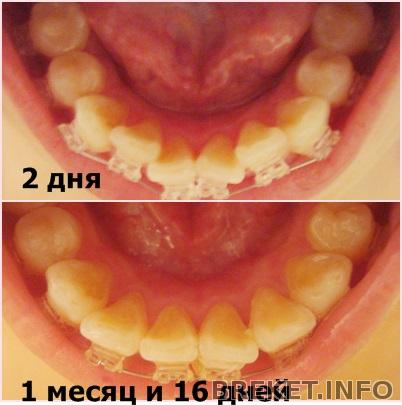 nch_1_mesyac_i_16_dney.jpg