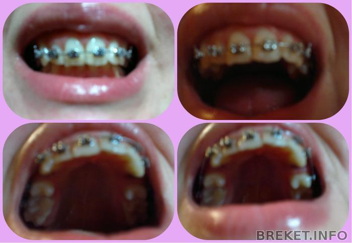 collage_1_month_17_day.jpg