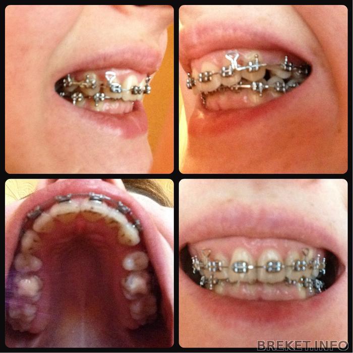 10_months_24_days_collage.jpg