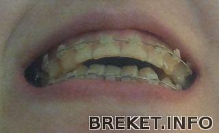 vch_4_mesyaca_12_dney_nch_1_mesyac_27_dney.jpg