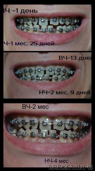 vch_2_m_nch-4_m.jpg