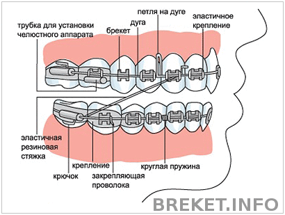 brek11.gif