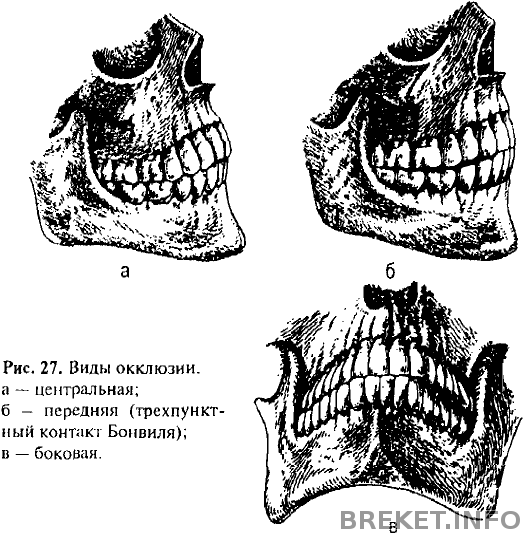 widy_occlusii.png