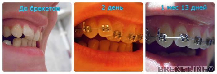 1_mes_13_dney_3.jpg