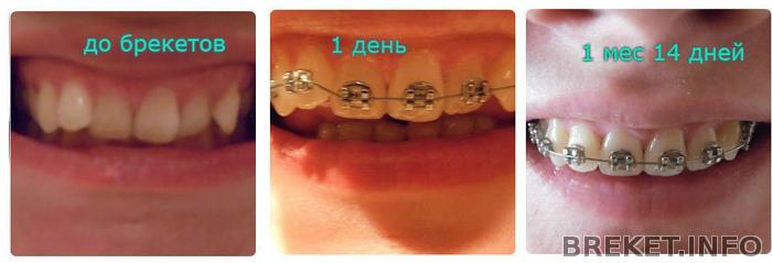 1_mes_14_dney_2.jpg