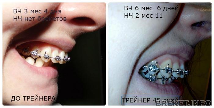 vch_3_i_4_mes_-_treyner_45_dney_nch_2_yu11.jpg