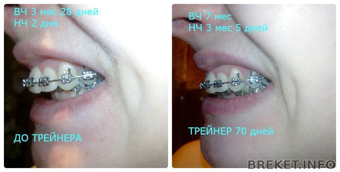 3.28_-_7_mes_treyner_70_dney.jpg