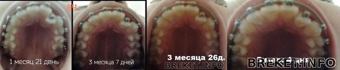 kollazh.1_mesyac_21_den-5_mesyacev_dnya.jpg
