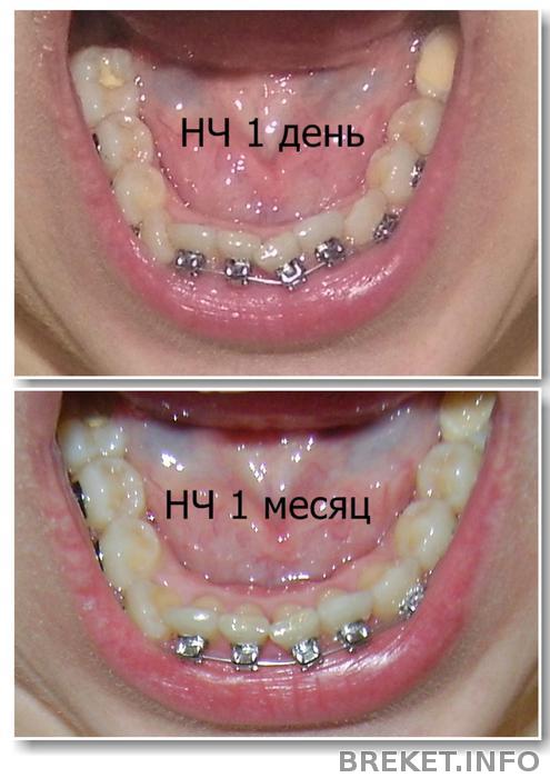 коллаж НЧ 1 месяц