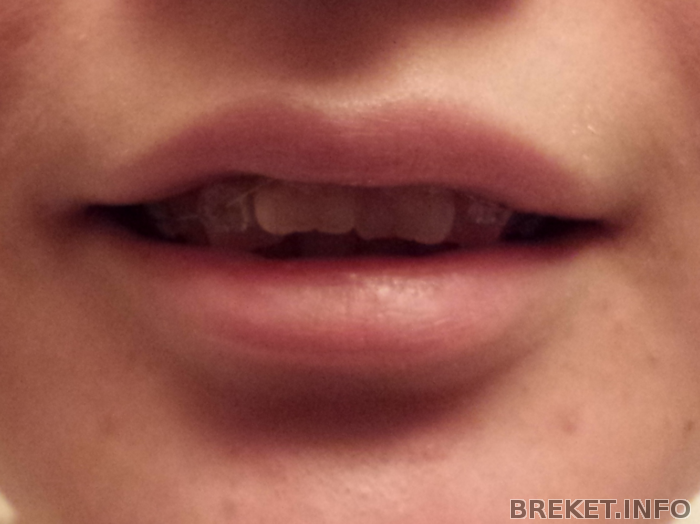 2013-10-25_21.16.07.png