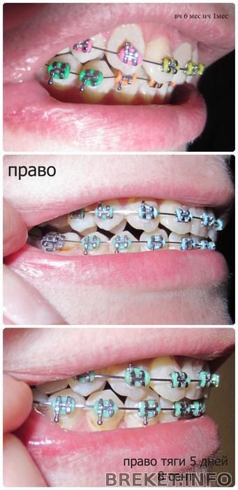 levo_kola_4_mes_tyagi_5_dney.jpg
