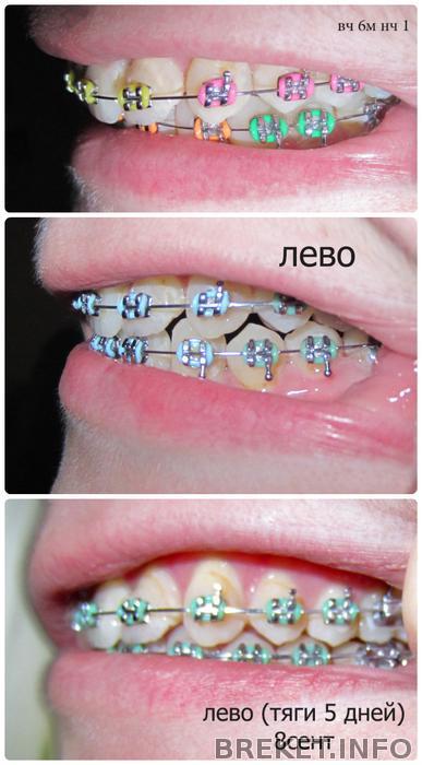 levo_kollazh_4mestyagi_5_dney.jpg