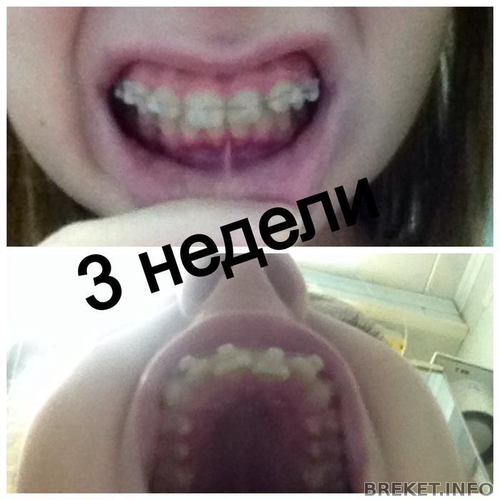 3 недели ВЧ