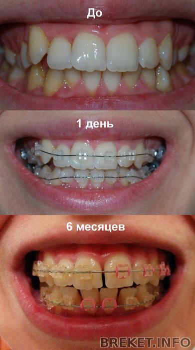 do-1_den-_6_mes_anfas.jpeg