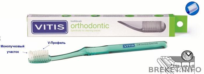 dentaid_vitis_orthodontic