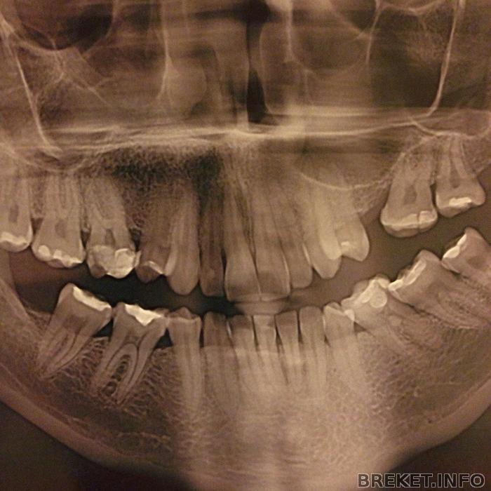Ортодонтограмма