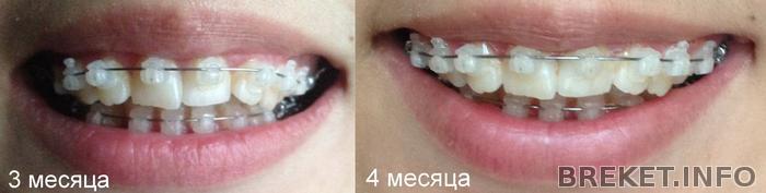 4_mesyaca.jpg