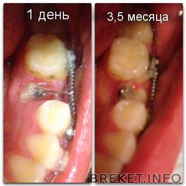 img_0614_novyy_razmer.jpg