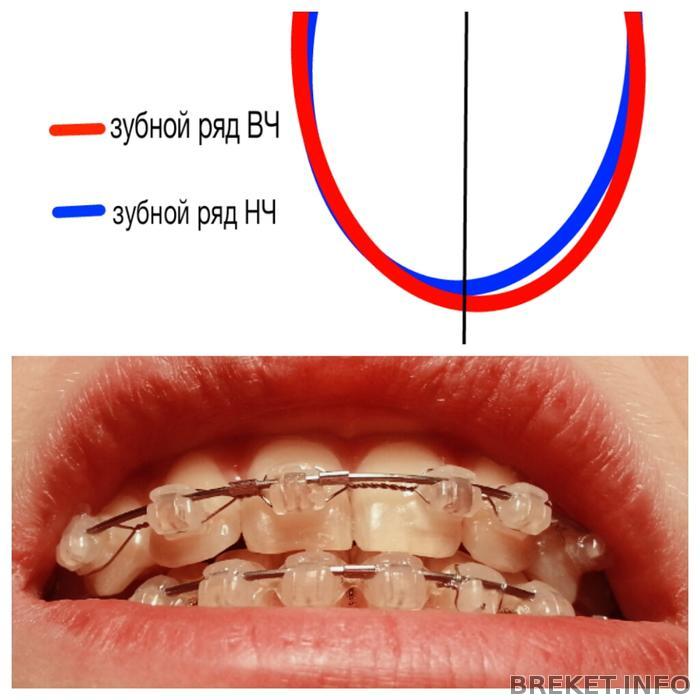 shchel_mezhdu_chelyustyami_sprava_bolshe_chem_sleva.jpg