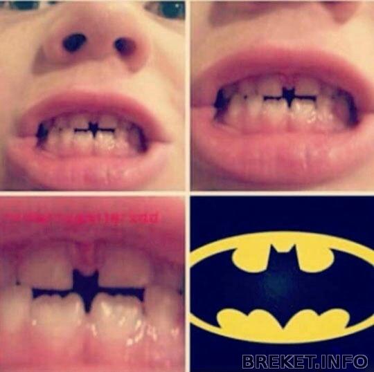 funny-teeth-batman-hole-symbol-01.jpeg