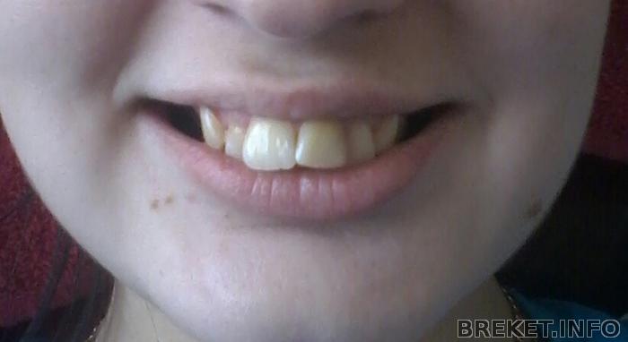 20140323_144951-1.jpg