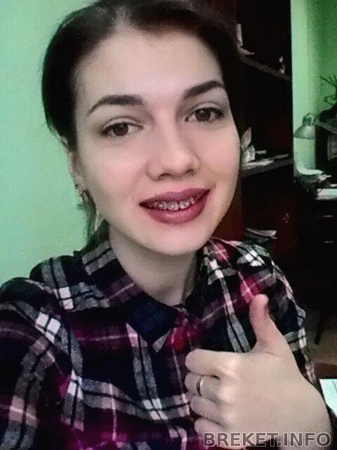 p_20170125_090429_1_bf_p.jpg