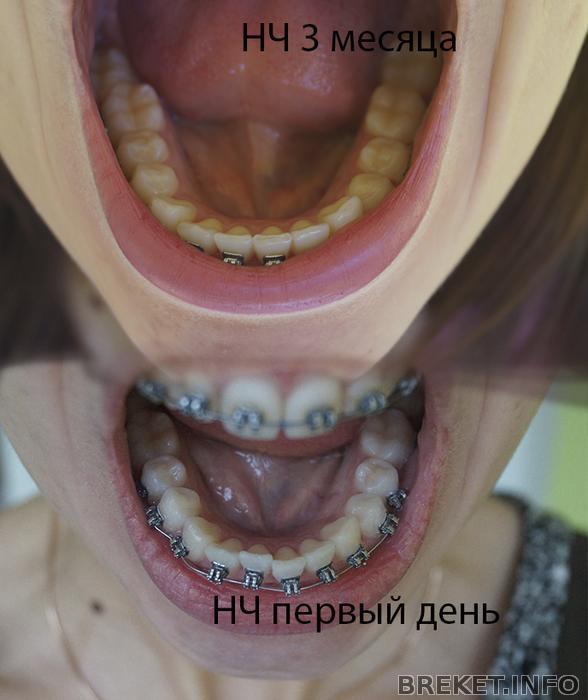 nch_pervyy_den_-_3_mes.jpg