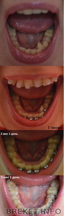 nch_3_mesyac_1_den.jpg