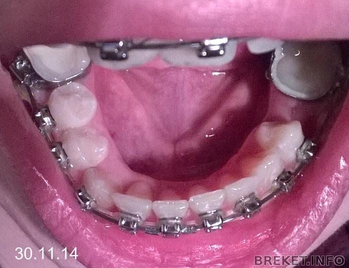 wp_20141130_002.jpg