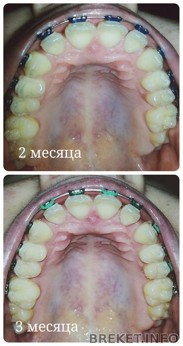 2 и 3 месяца: почти без изменений