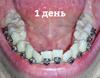 НЧ 1 день