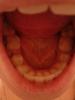 Предпоследние зубы сьехали внутрь челюсти (на фото меньше заметно, чем в жизни)