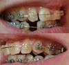 зубы 1