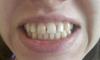 20160405_160817_resized.jpg