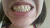 20160405_160824_resized.jpg