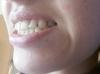 20160405_160914_resized.jpg