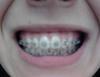 smieshchieniie_tsientrov._pieriekos_dughi_na_nch.jpg