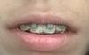wp_20170601_10_29_13_selfie_2.jpg