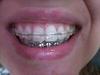 20130517_125629.jpg