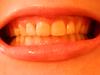 dscn2468.jpg