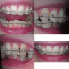 photogrid_1366620375706.png