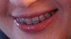 br444.gif